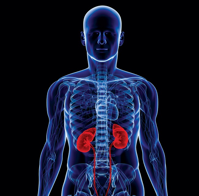 Sri Lanka to hold international conference to tackle chronic kidney disease