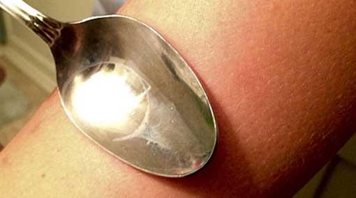 Mother burns 4-year-old using metal spoon