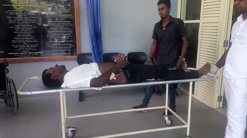 SLTB bus driver critically injured in assault