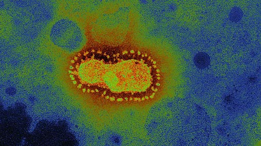 Suspected Coronavirus cases rise to four