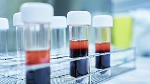 86 COVID-19 cases identified in Sri Lanka