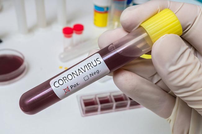 Sri Lankas coronavirus cases climb to 91