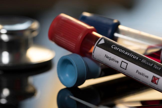 115 coronavirus cases in Sri Lanka