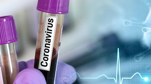 152 confirmed cases of Covid-19 in Sri Lanka, 24 recovered
