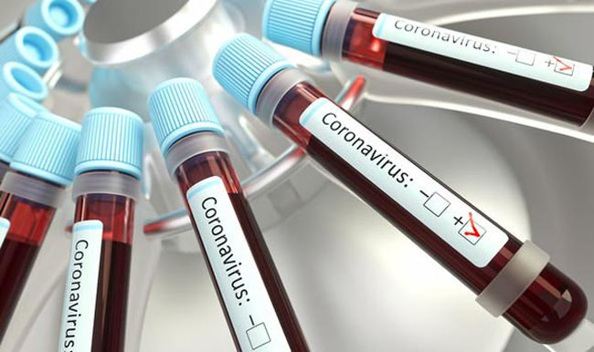 COVID-19 case count in Sri Lanka reaches 166