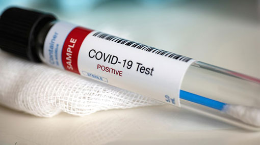Three more Covid-19 cases brings total to 183