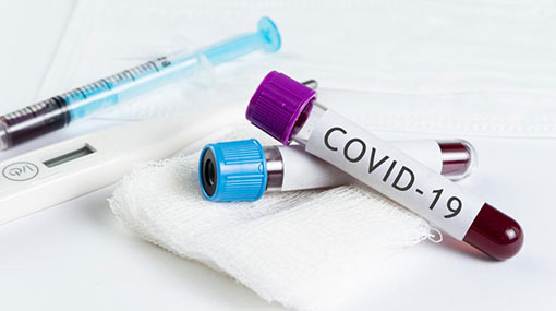 COVID-19 cases increase to 189, recoveries climb to 44