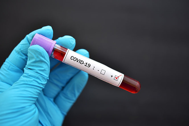 COVID-19 cases in Sri Lanka climb to 198