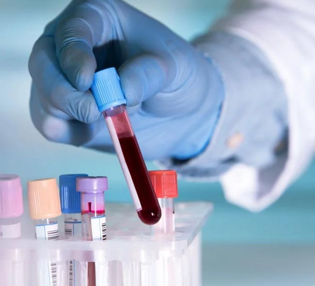 Another COVID-19 patient adds up to 199 total cases