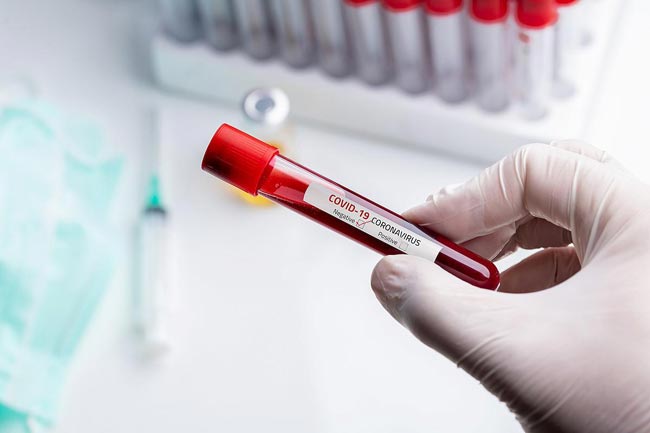 Sri Lanka reports another coronavirus recovery