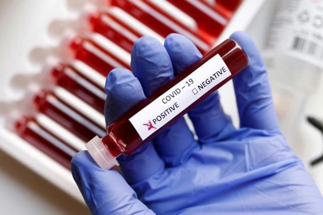 7 new infections bring COVID-19 cases count to 210