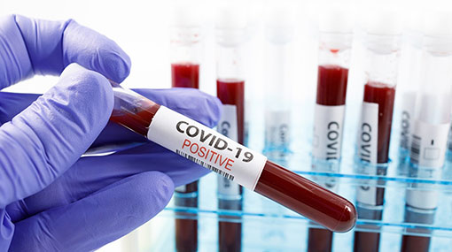 Covid-19 cases in Sri Lanka climbs to 217