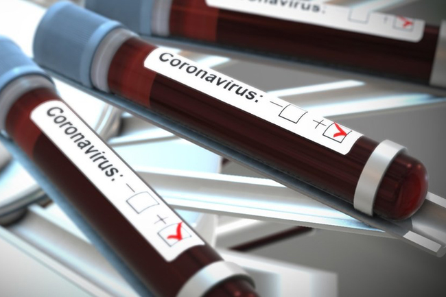 COVID-19: Sri Lankas cases tally jumps to 241