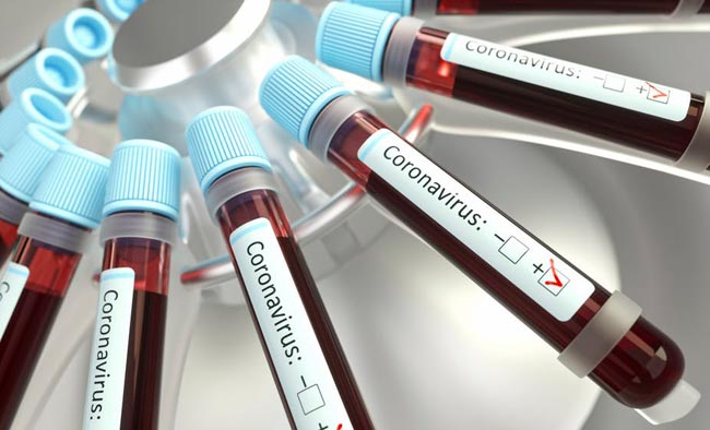 COVID-19: Fifteen new cases bring total to 269