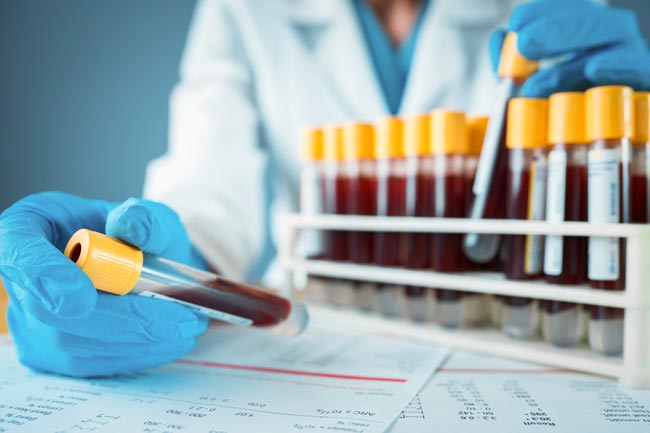 COVID-19 case count soars to 295 with 24 new cases