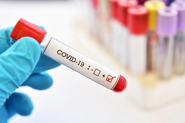 One more COVID-19 case reported; total at 304