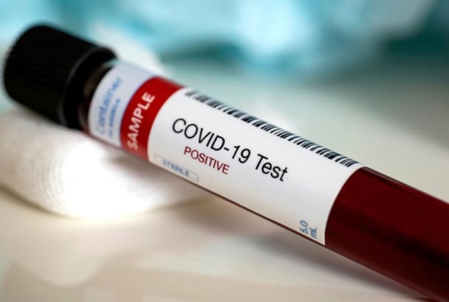 One more COVID-19 case raises tally to 322