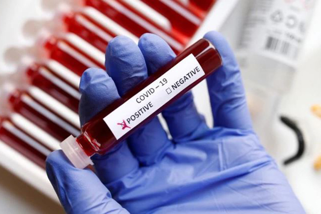 Four new COVID-19 cases detected; Total at 334