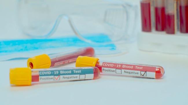 Coronavirus case total in Sri Lanka at 335