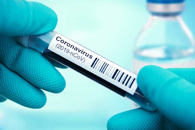 Coronavirus cases climb to 373 as five more test positive