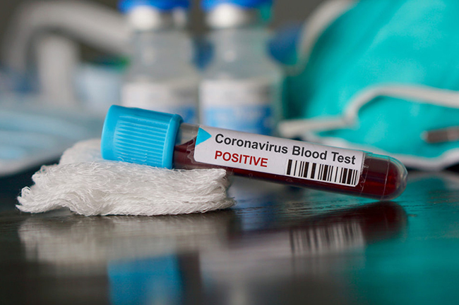 Another coronavirus case brings total count to 417