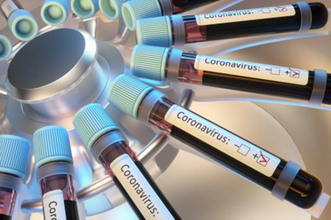 COVID-19 cases tally soars to 435 with 15 new infections