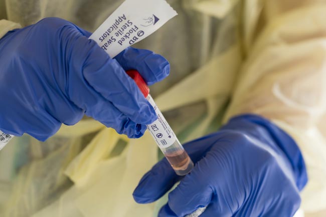 Three new cases bring COVID-19 case count to 452