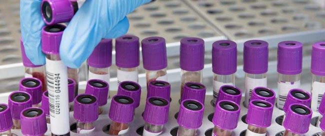 Total count at 471 with 4 new COVID-19 cases