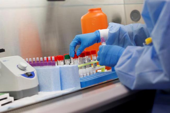 Universities to join PCR testing process