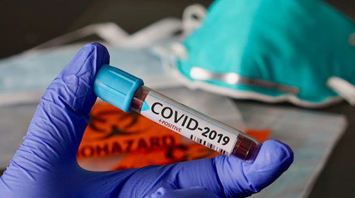 34 new COVID-19 cases brings Sri Lankas total to 557