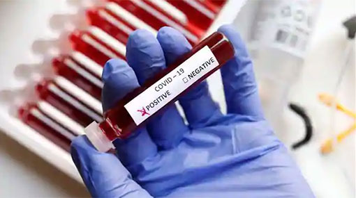 Covid-19 cases in Sri Lanka climbs to 567
