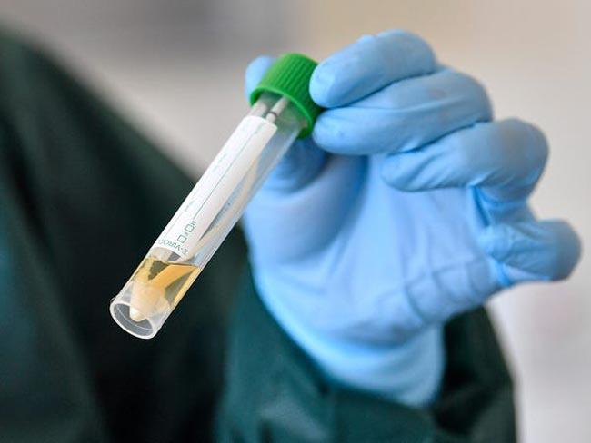 Coronavirus cases tally in Sri Lanka at 584