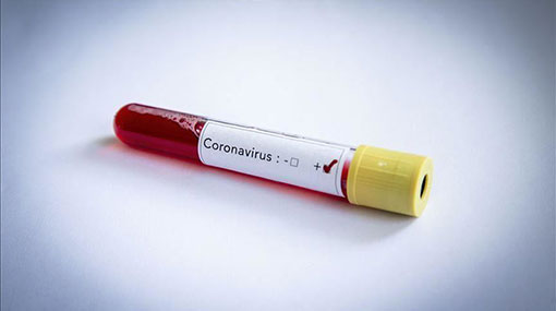 Confirmed COVID-19 cases climb to 630
