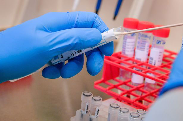 Sri Lanka confirms 19 new Covid-19 cases, taking total to 649