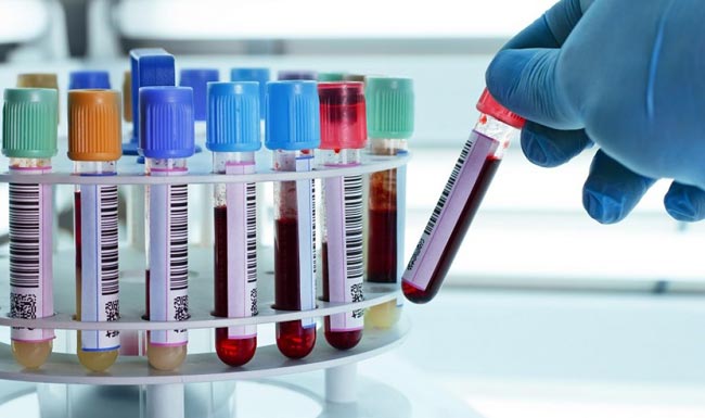 COVID-19: Seven more cases, tally at 660