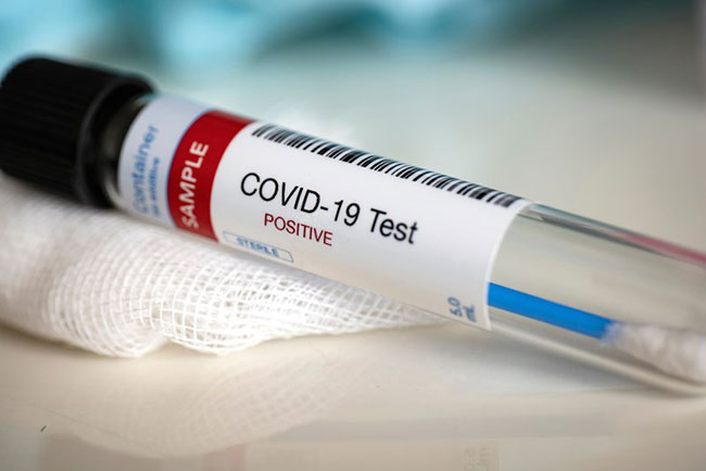 COVID-19: One new confirmed case brings total to 666