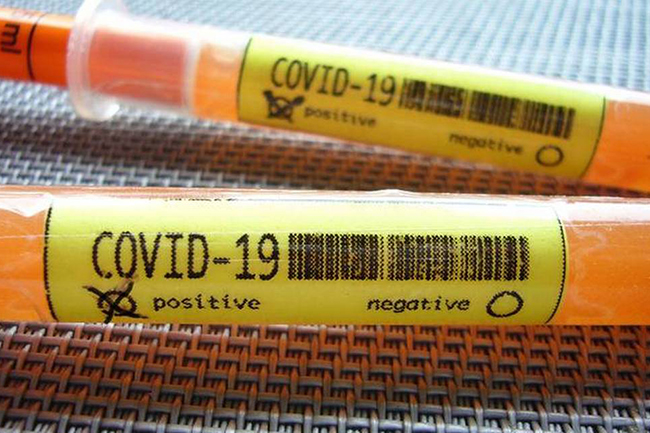 Confirmed COVID-19 cases hit 668 as two more test positive