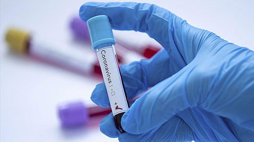 Total number of confirmed Covid-19 cases rise to 671