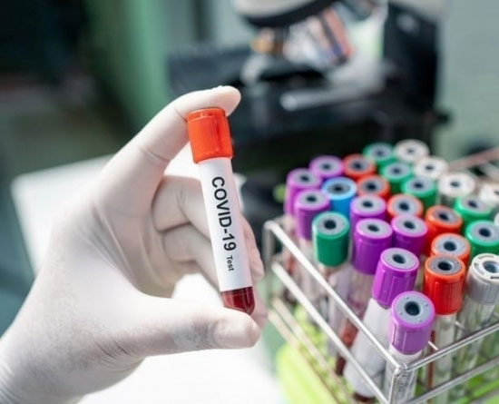 Covid-19: confirmed cases in Sri Lanka rises to 771