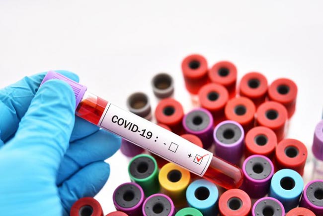 Total jumps to 795 with 21 new coronavirus cases