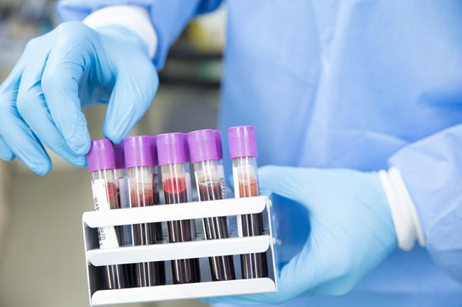 COVID-19: Five new positive cases take tally to 1,206
