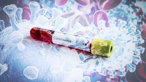 21 new cases of Covid-19 brings total to 1,524