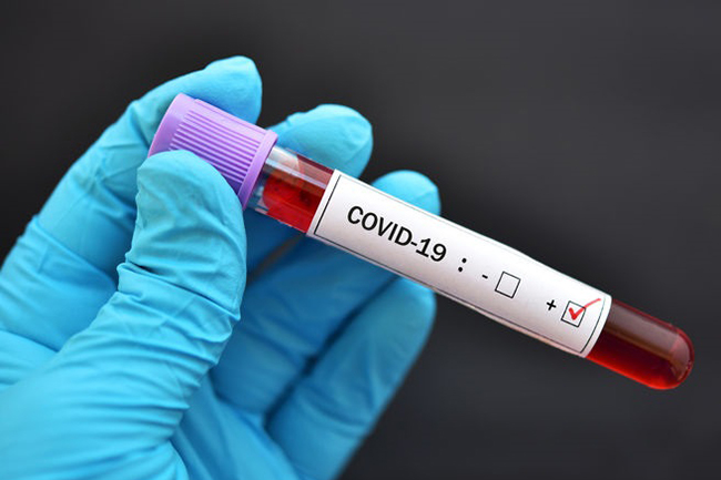 One fresh COVID-19 case takes total count to 1,559