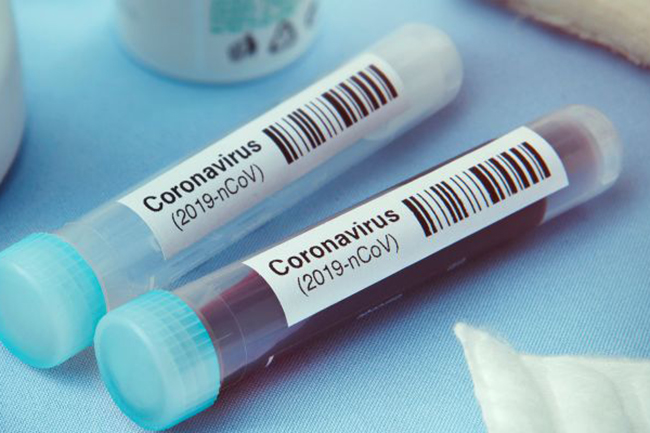 Coronavirus infections hike to 1,561 with two new patients