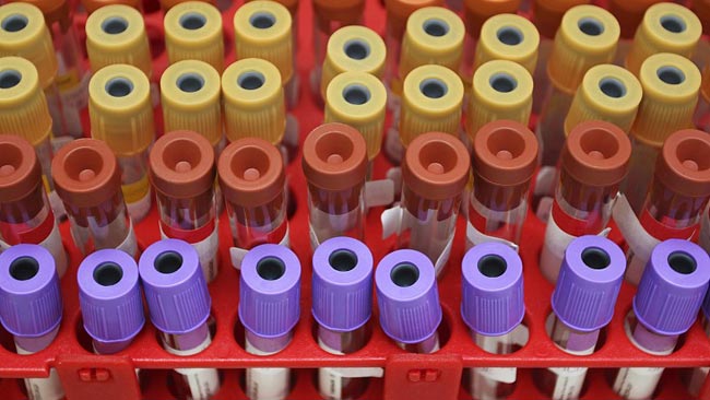 Coronavirus: Forty seven fresh cases identified