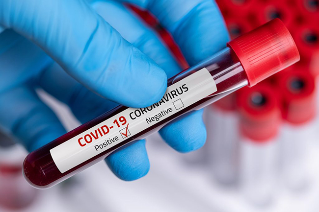 Another navy man tests positive for Coronavirus as cases hit 1,631