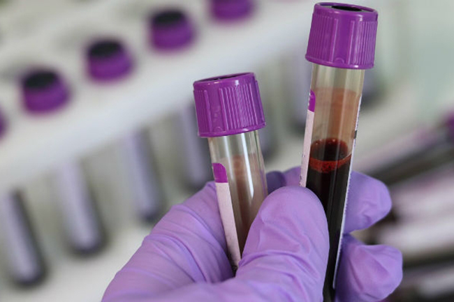 COVID-19 infections in Sri Lanka rise to 2,661