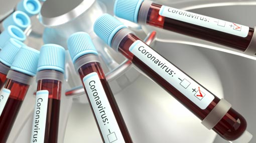 Four more from Kandakadu rehab center test coronavirus-positive