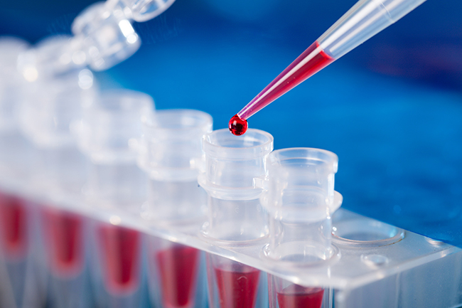 COVID-19 Fund allocates Rs.36 million to carry out PCR tests