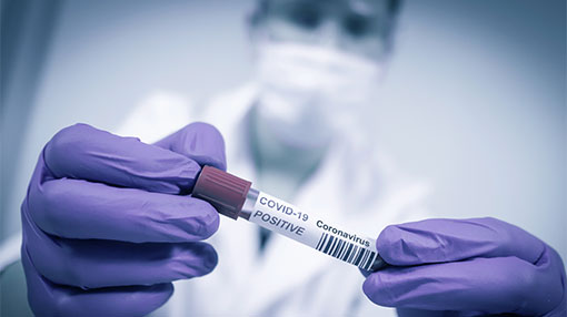 Covid-19 tally jumps to 2,804 with 22 fresh cases